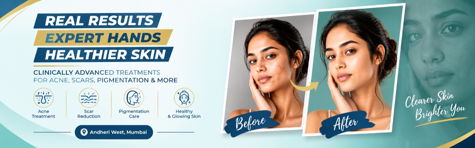 Real results, expert hands, healthier skin — clinically advanced treatments for acne, scars and pigmentation