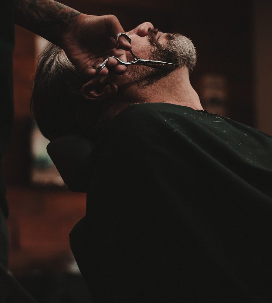 Beard Transplant